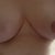 5 weeks post op