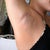 06/03/12--- My right arm 4 days later. The bruises are fading, and the swelling has gone down A LOT! (Because of the constant icing!) The 'uncomfortable' feelings have subsided. All feels normal!