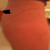 Almost 2 years later + extra weight gain: