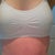 6 weeks post op