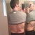 treated side is on the left side