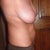 Before...You can tell my waist is like a box, so I am happy Dra. Robles gave me curves!