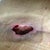 What I'm dealing with 6 weeks PO. seroma