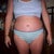 11-22-11 3 weeks post op ~ still really swollen