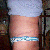11-22-11 3 weeks post op ~ still really swollen