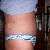 11-22-11 3 weeks post op ~ still really swollen