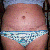 11-22-11 3 weeks post op ~ still really swollen ~ looks GREAT! Really dry, but I'm not allowed to put anything on the incision for another 2 weeks :(