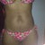 So many stretch marks. front view