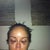 I think the flash makes the bruising look worse (about 6 hours after surgery).