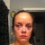 The bruising's bad but not as bad as the flash made it look (about 6 hours after surgery - the bruising came on really fast!  And what lovely, swollen eyes!).