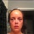Goodnight, Day 1!  Looking better already (about 14 hours after surgery).