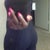 4 week 2 days post op...no compression garment...