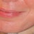 Before ePrime procedure