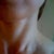 Day 75 after ePrime procedure (using elure Advanced Skin Lightening and one Vitalize peel)