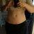 you can see on the right side of the pic there are "rolls".. dont know if this is fat or swelling. hope it flattens out as the months progress with healing and exercise.