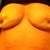 20 Days Post