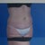 Before #2