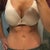 17 weeks post op :)