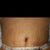 First time seeing my new belly... Drains still in... But it's flat... :)