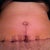 Belly button 12 days PO