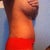 16 days post op