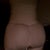 About 5 days Post Op