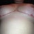 under at 8 weeks, everything is healed up nicely and love the shape