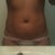 After pic