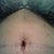 Belly Button...3 days PO