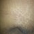 this is the rash that I get from my belts because my stomach hangs over