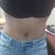 My Belly Button 8/23/2010 2 months post op