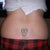 Back side pre-op tummy tuck