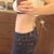 2.5 weeks postop. I am amazed that this is me. So happy!