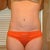 1 Year PO front showing scar