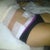 Post op day one!!!  Such a change