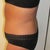 8 weeks side