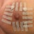 Incision is helling nice. One week n 3 days since the revision.