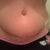 close up bb n incision 18 days