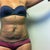 taken at a consult. UGGGGGGGGGH THE LOOSE SKINNNNNNN