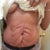 3 days pre op