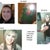 This was at my 1 year 6 month mark...but it shows good before pics
