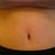 Close up of my BB (5 weeks post op)
