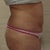2/2013 Side after 2 babies c-section in june 2012