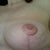 boobie - scar at 15 wks x