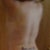 4 weeks post op