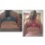 Week 3 - Back before & after