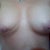 3 weeks PO You can REALLY see the weird indentation on my right breast in this one.