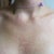 This is what the rash looks like, and it's EVERYWHERE!!
