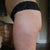 left lateral thigh, the major dimples appear almost frickin' GONE!
