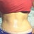 Back to swollen again on one side 4 weeks